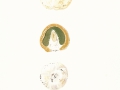 Phallus impudicus L. , Stinkmorchel