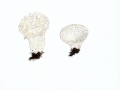 Lycoperdon mammaeforme Pers. , Flockenstäubling