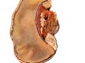Fomes fomentarius (L.: Fr.) Fr. 2 , Zunderschwamm