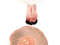 Amanita rubescens Pers. , Perlpilz, Rötender Wulstling
